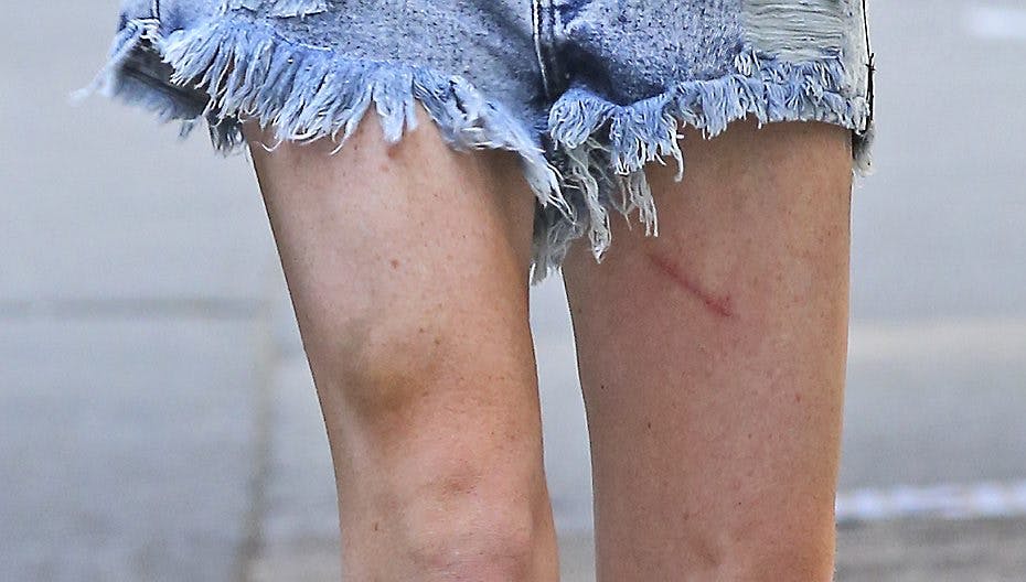 Der er ikke meget stjerne over de stænger.