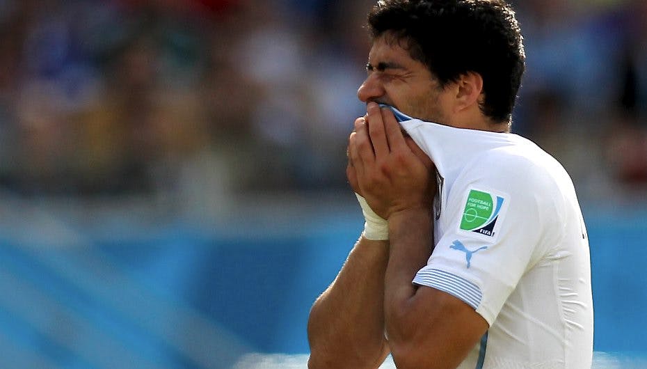Under kampen slap Luis Suarez fra det skandaløse bid med tandsmerter