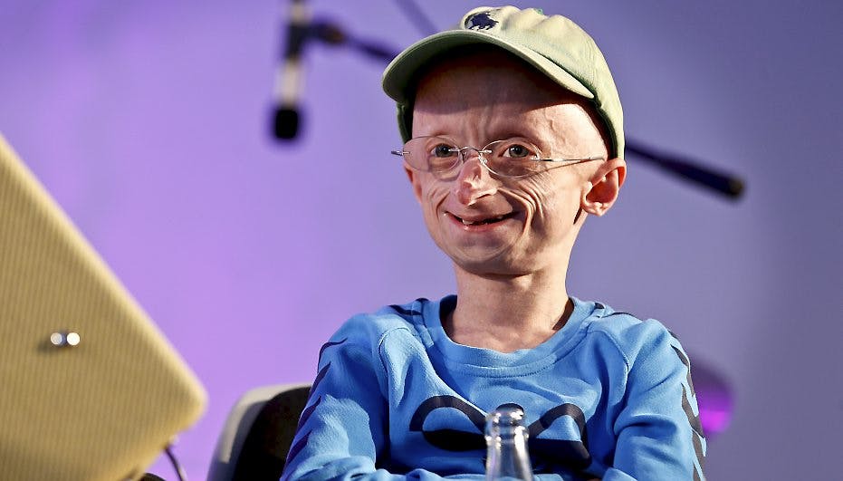 Altid positive Jesper Sørensen blev i dag udnævnt til æresborger i Fårup Sommerland.