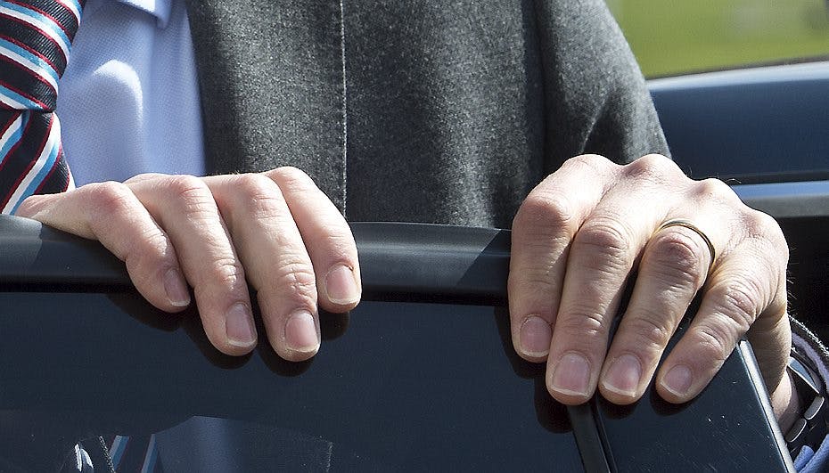 Hvilken kongelig person ejer disse negle?