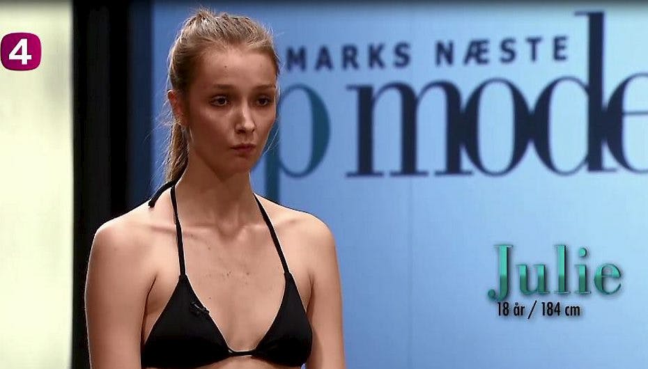 Uffe Buchard advarer 18-årige Julie, at hun ikke må tabe sig yderligere