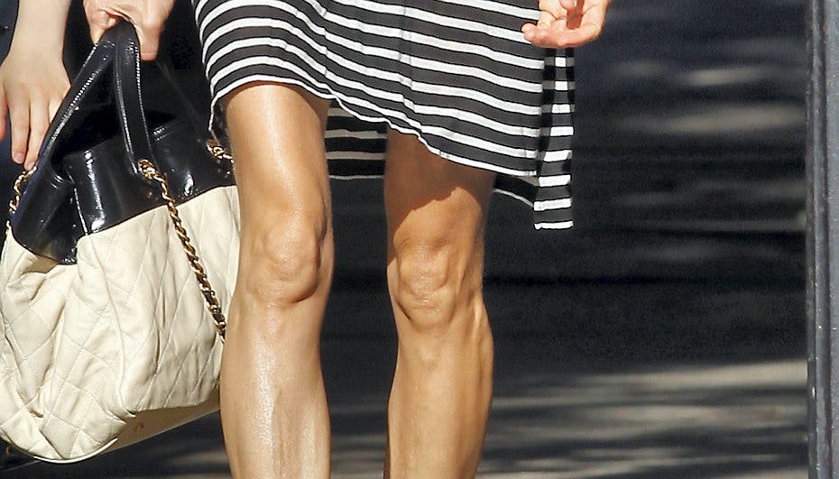 Hvem er indehaveren af disse stænger?