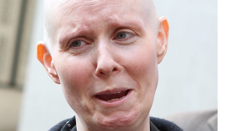 I månedsvis har stjernen været hårløs, men det er slut nu