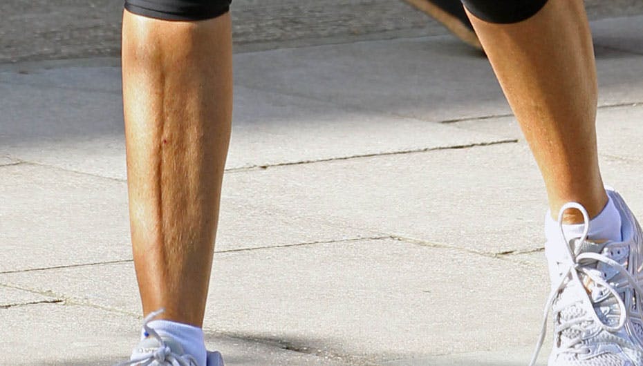 Hvilke supermodel ejer disse ubarberede ben?