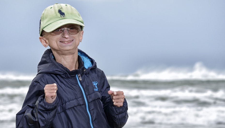 Trods sin sygdom har Jesper Sørensen fra Nordjyllan det godt