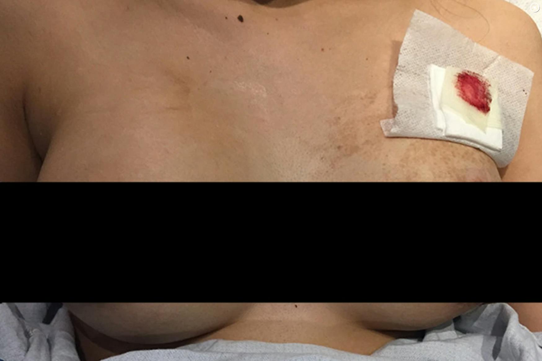 https://imgix.seoghoer.dk/media/article/2020-04-23_10_11_42-womans_breast_implants_deflect_bullet_and_save_her_life.png