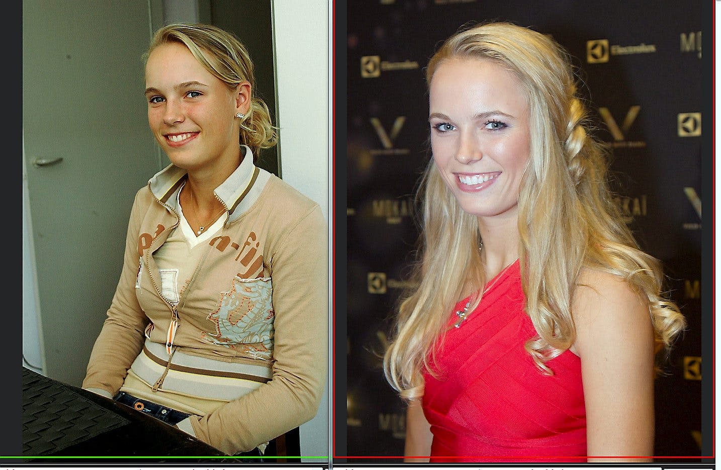 https://imgix.seoghoer.dk/media/article/caroline_wozniacki_vild_forvandling_2.jpg