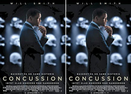https://imgix.seoghoer.dk/media/article/concussion_to_billeder.jpg