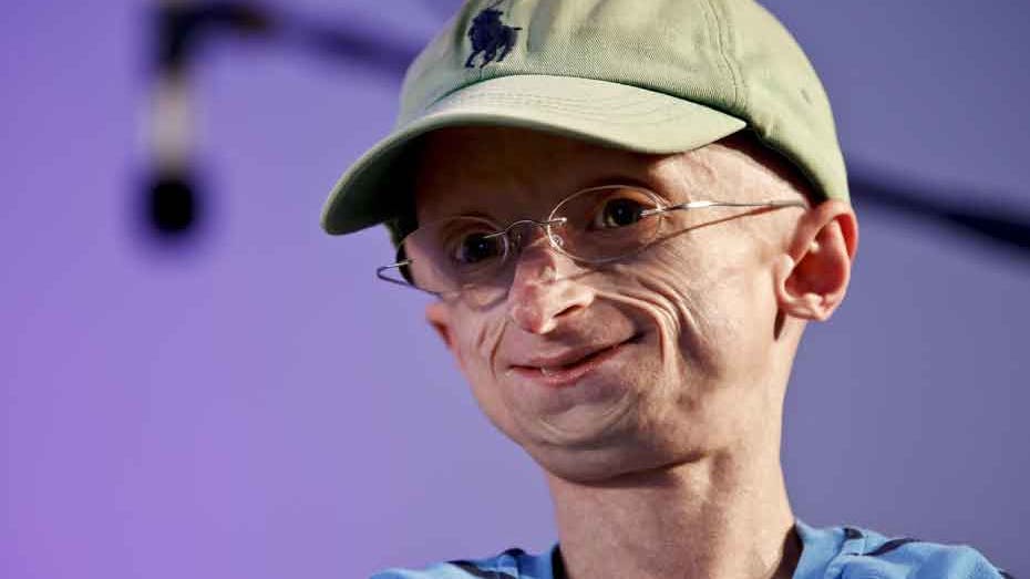 https://imgix.seoghoer.dk/media/article/progeria-jesper-soerensen-03.jpg
