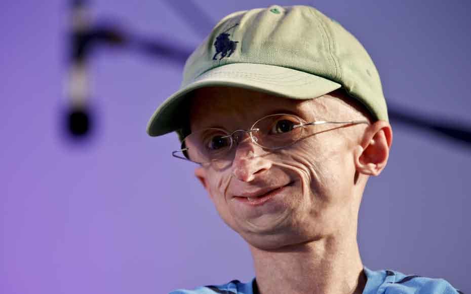 https://imgix.seoghoer.dk/media/article/progeria-jesper-soerensen-03.jpg