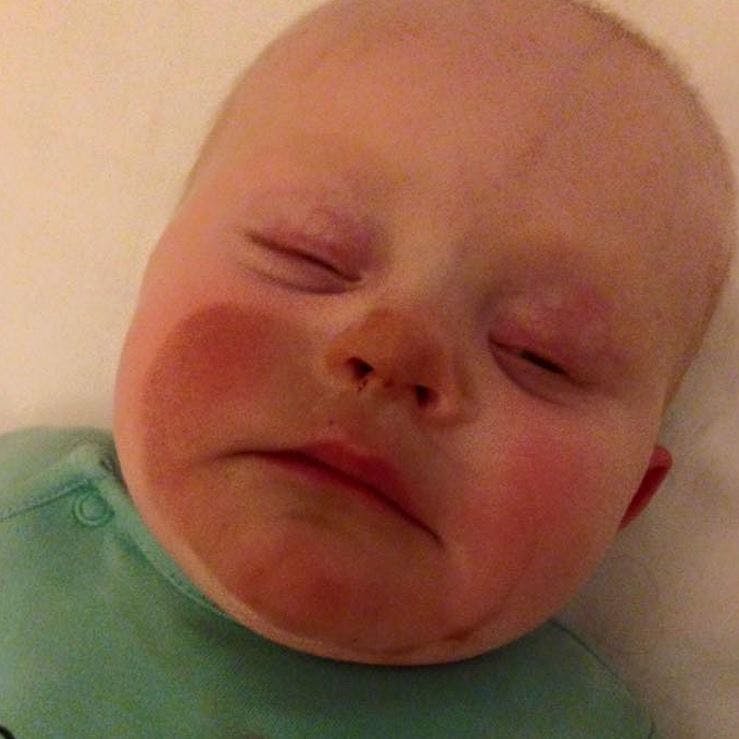 https://imgix.seoghoer.dk/media/article/tan_baby.jpg