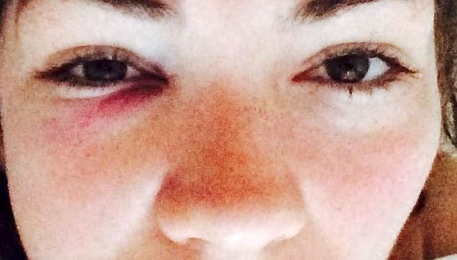 Freja Kirk og kæresten er begge chokerede over overfaldet