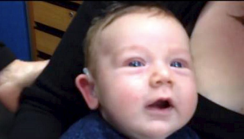 Lille Lachlan blev født med svær hørenedsættelse - denne video viser øjebilkket, hvor han hører sine forældres stemmer for første gang