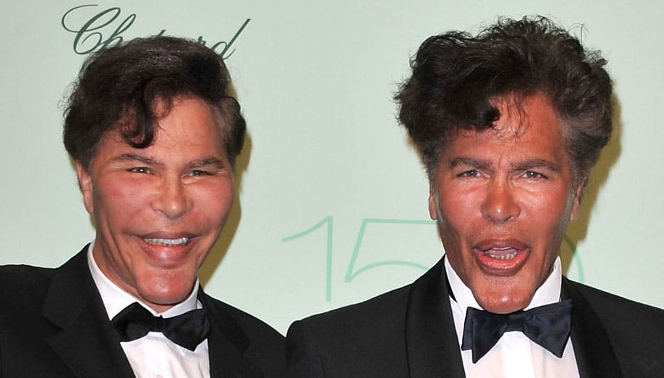 Det er ikke til at se det, men Bogdanoff-brødrene er faktisk levende