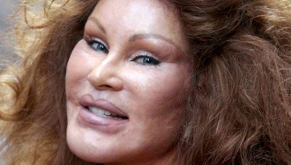 Jocelyn Wildenstein er et eksempel på, at plastikoperationer ikke altid gør dig kønnere