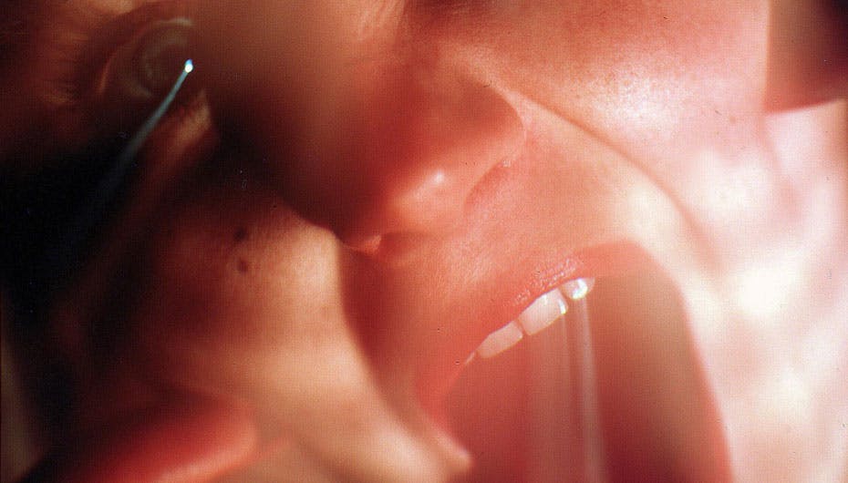 Se en af de mest gennemførte pranks på TV herunder