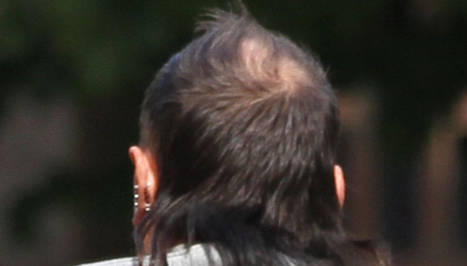 Han er blevet en anelse tynd i toppen, den gode TV-stjerne