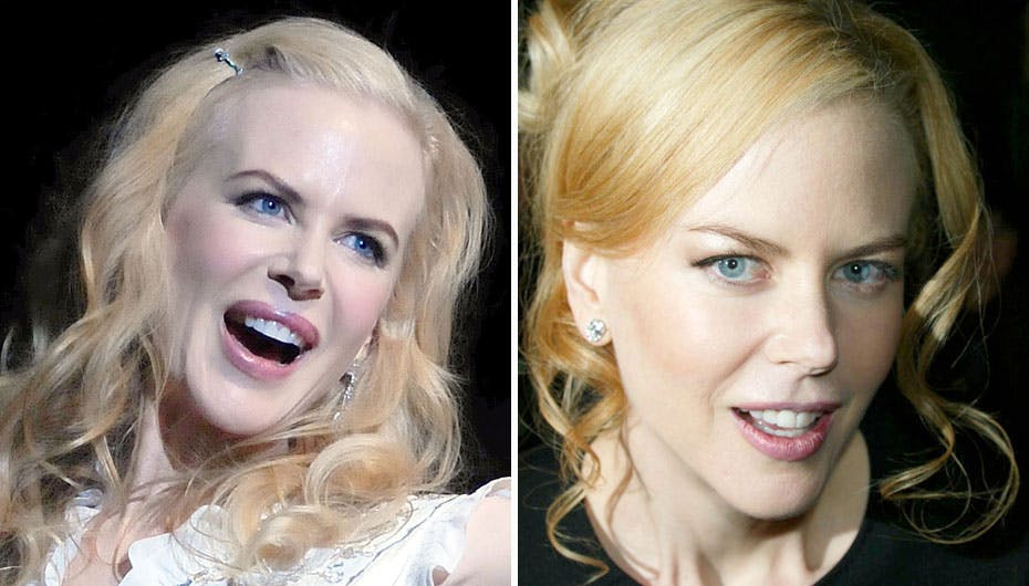 Nicole Kidman med store læber, masser af hvid pudder og Botox. Til højre er den naturlige skønne skuespiller