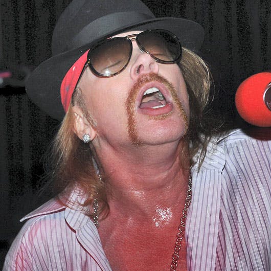 https://imgix.seoghoer.dk/media/se-og-hoer/2010/musik/februar/axl-rose-knivstikker-jpg.jpg