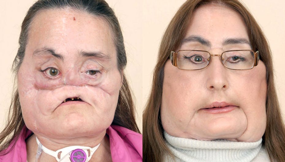 Connies mand sidder i fængsel på grund af mordforsøget mod hende - hun har dog tilgivet og venter på han kommer ud til hende igen (Foto: Cleveland Clinic