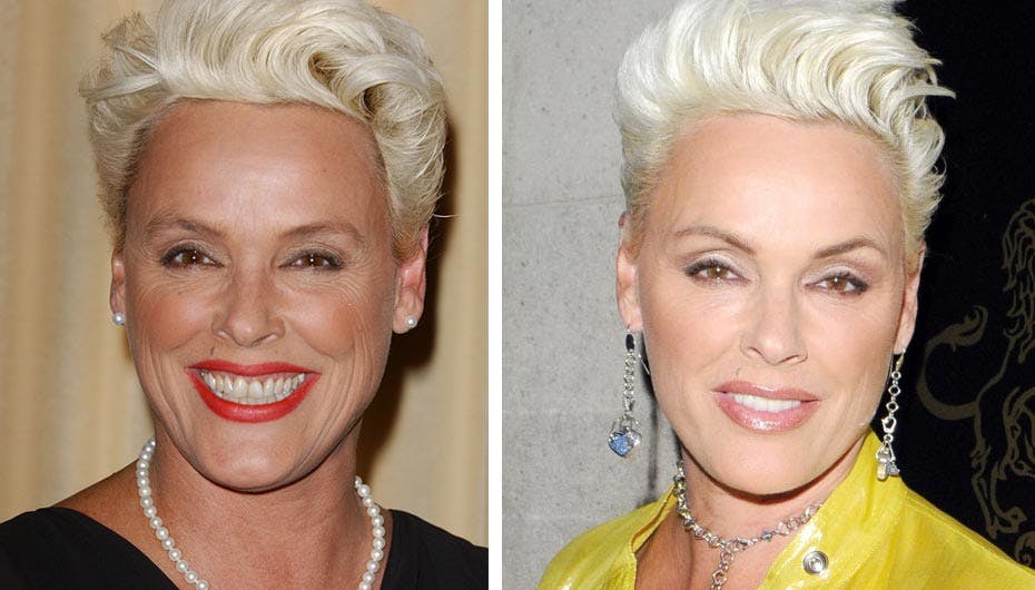 Brigitte Nielsen før og efter utallige operationer. Før-billedet er taget den 24. April i år mens efter-billedet er fra torsdag aften