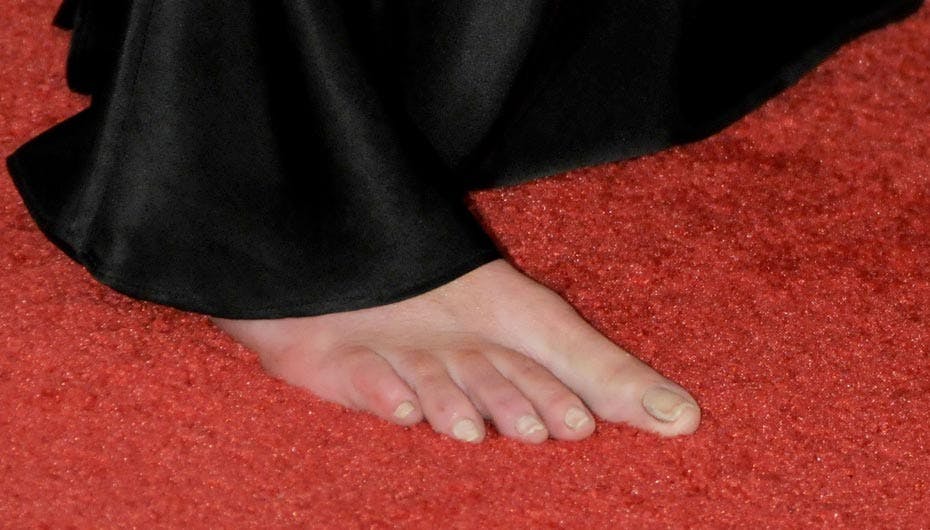 Hvem mon er den stolte ejer af denne mildest talt ufikse fod?