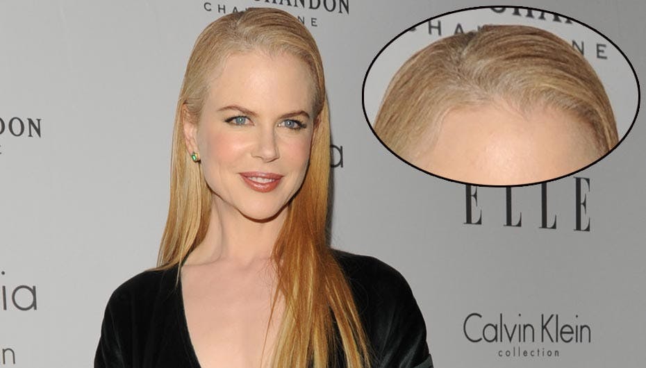 Nicole Kidman er blevet grå i toppen