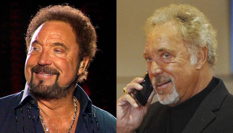 Tom Jones har besluttet at droppe det farvede hår efter lægernes anbefaling