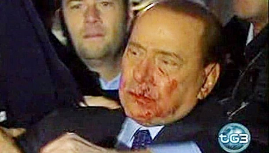 73-årige Silvio Berlusconi var slemt tilredt efter overfaldet