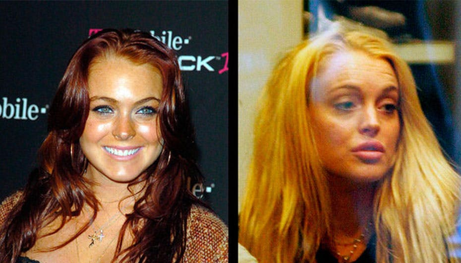 Lindsay er blevet blondine med silikonelæber og er ved at ødelægge sit ellers så fine særpræg fuldstændig