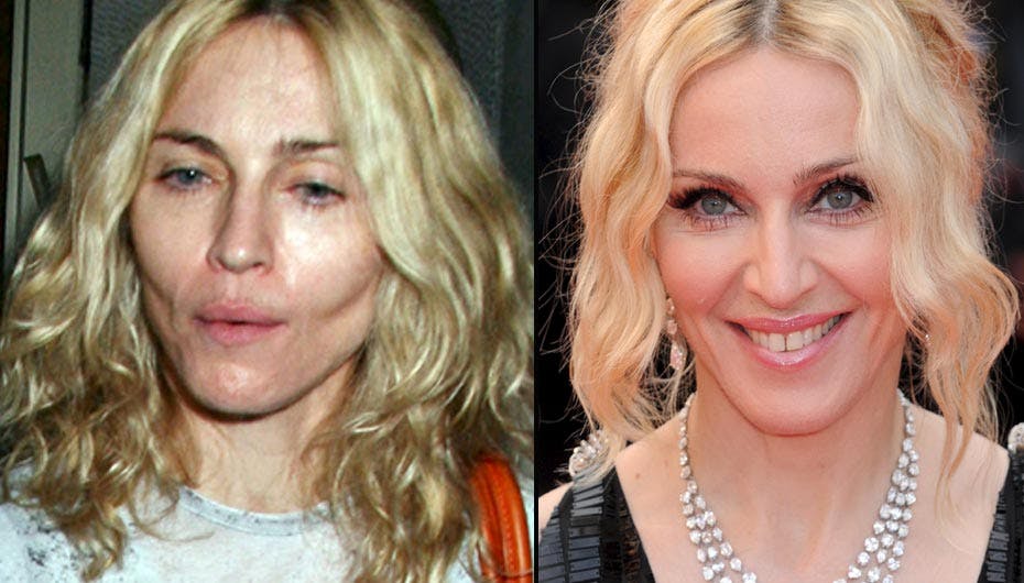 Tv. Madonna for nogle uger siden chokerede verden med sit margre og blege ansigt. Th. bare få uger før lignede fødselsdagsbarnet den strålende stjerne, hun er