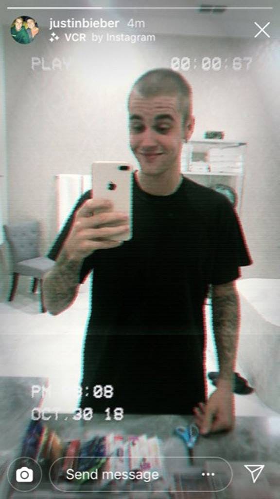 https://imgix.seoghoer.dk/rs_576x1024-181030184152-justin-bieber-shaved-head.jpg