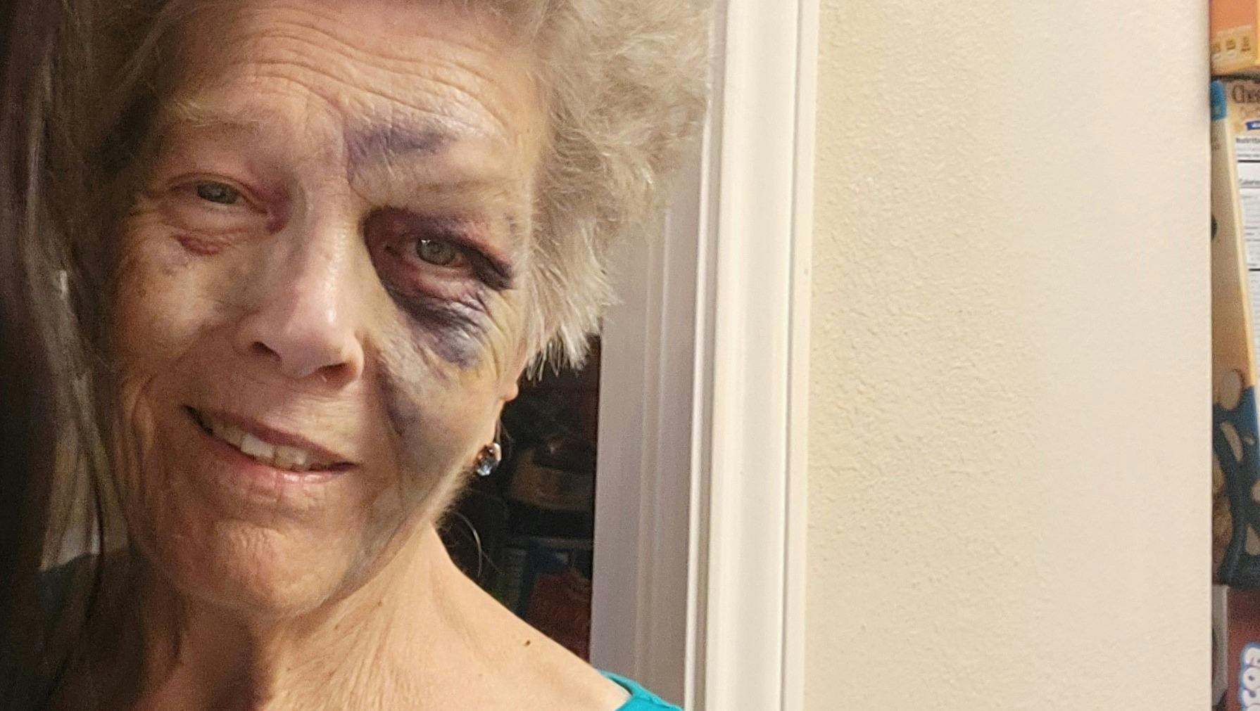 https://imgix.seoghoer.dk/shirlene_72_old_grandmom_beaten.jpg