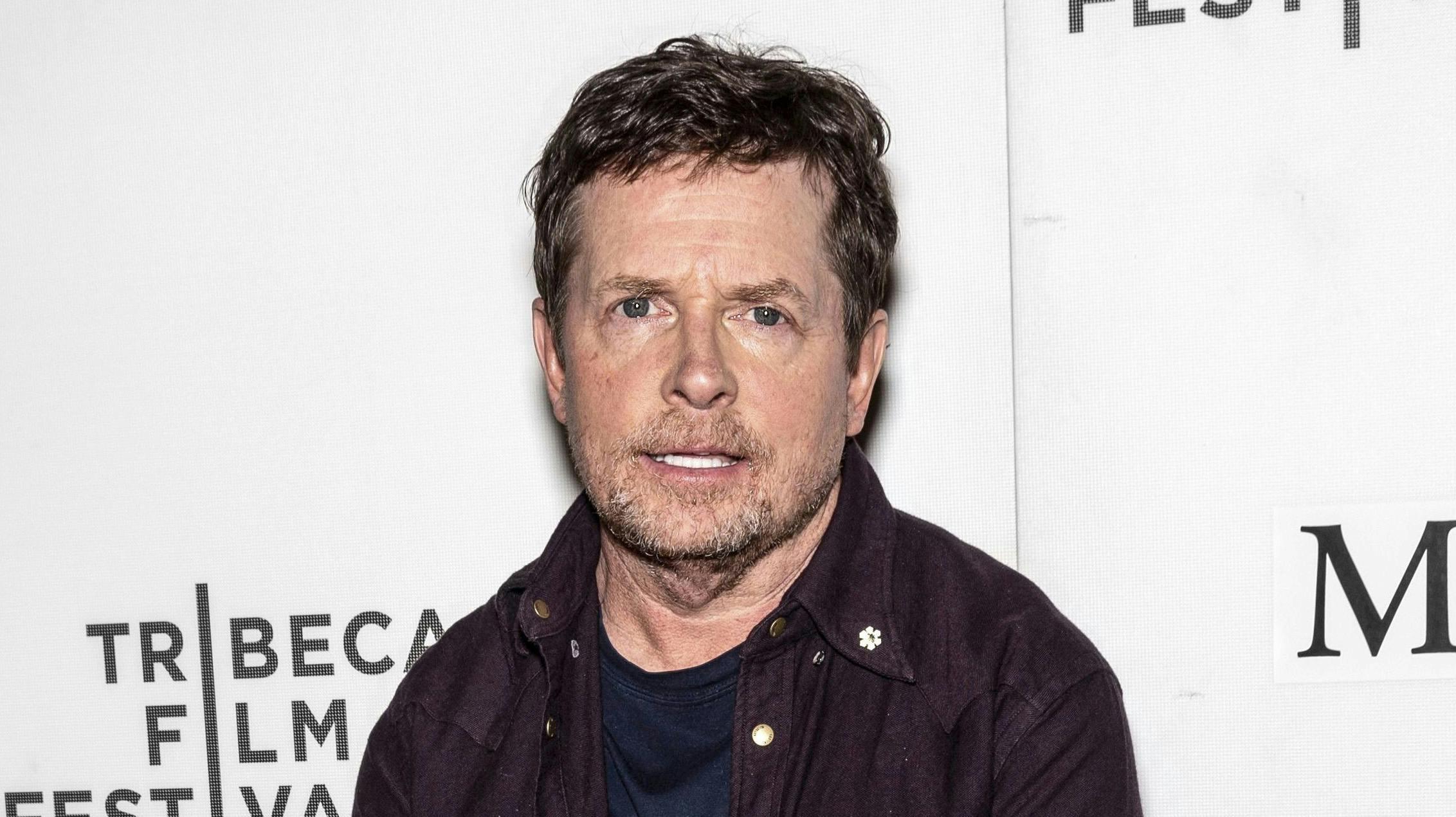 Den amerikanske skuespiller Michael J. Fox var kun 29 år og på toppen af sin karriere, da han blev ramt af Parkinsons sygdom.
